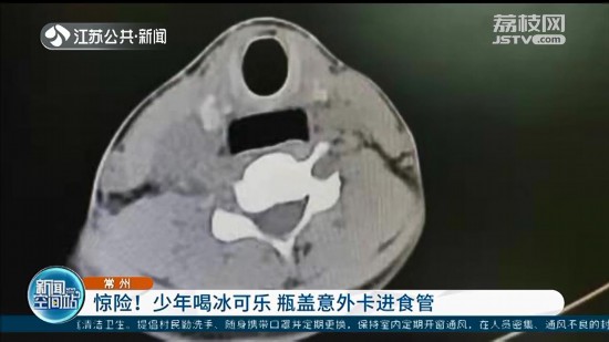 ��������ȱ��ɘ���ƿ�w���⿨�M(j��n)ʳ�� ȫ�����g(sh��)��ȡ��